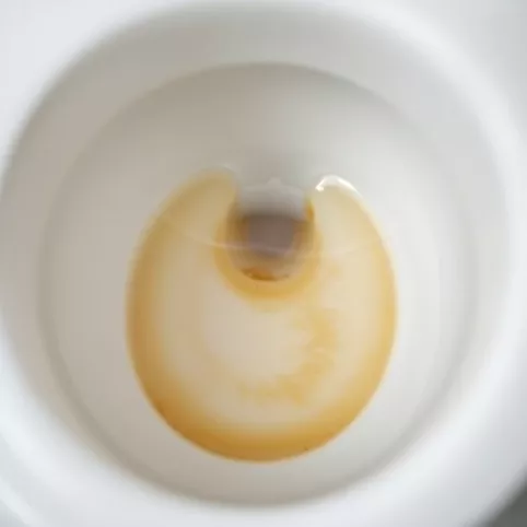 Jak Usunąć Kamień Z Dna Muszli Klozetowej